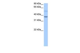 Antibody used in WB on Human Liver at 0.2-1 ug/ml.