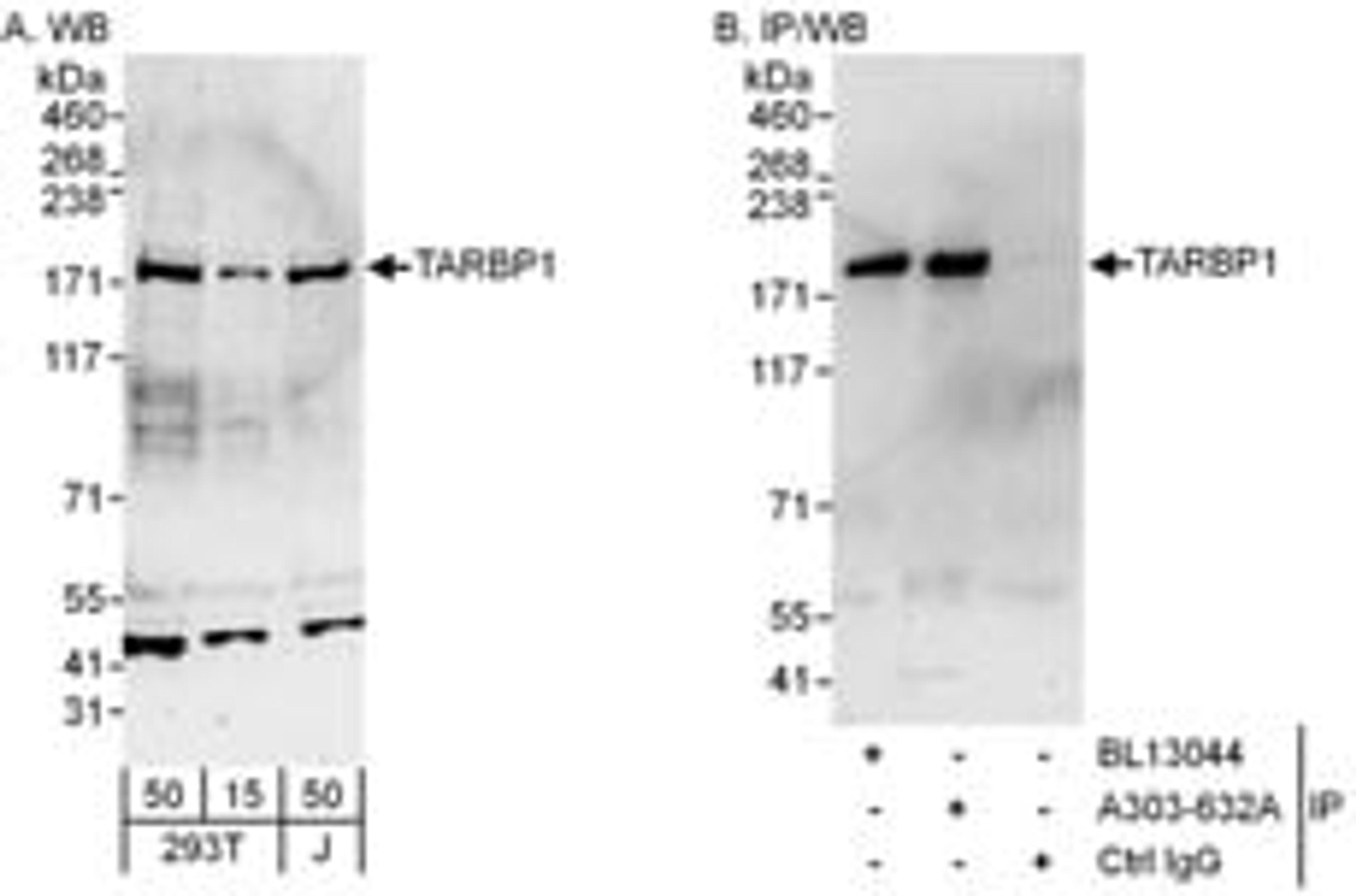 Detection of human TARBP1 by western blot and immunoprecipitation.