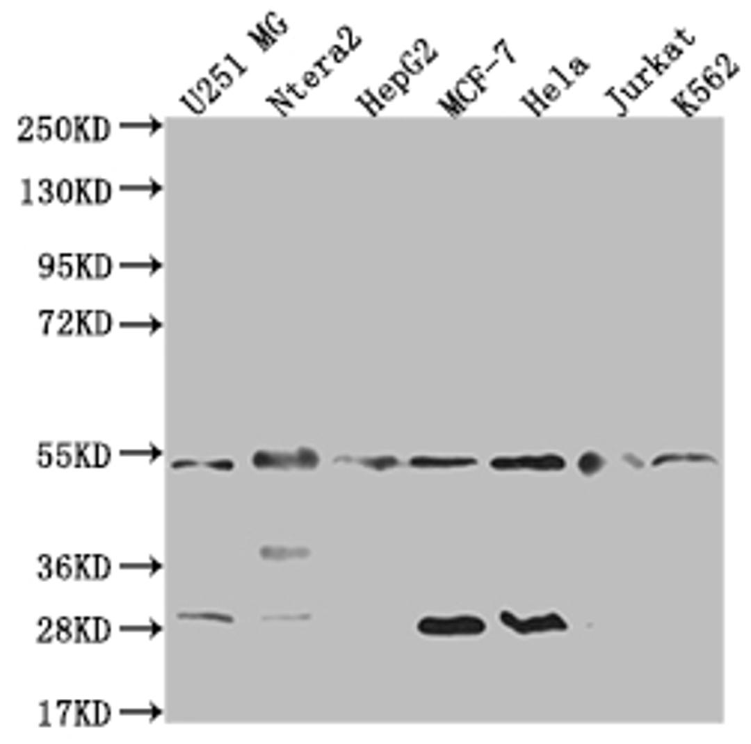 Western Blot. Positive WB detected in: U251 whole cell lysate, Ntera-2 whole cell lysate, HepG2 whole cell lysate, MCF-7 whole cell lysate, Hela whole cell lysate, Jurkat whole cell lysate, K562 whole cell lysate. All lanes: DNAJA1 antibody at 1:2000. Secondary. Goat polyclonal to rabbit IgG at 1/50000 dilution. Predicted band size: 45, 38 kDa. Observed band size: 45-55 kDa. 