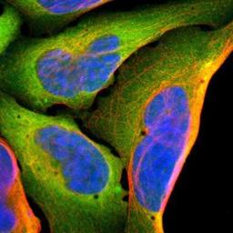 Immunocytochemistry/Immunofluorescence: AHSA1 Antibody [NBP1-88419] - Staining of human cell line U-2 OS shows positivity in cytoplasm.