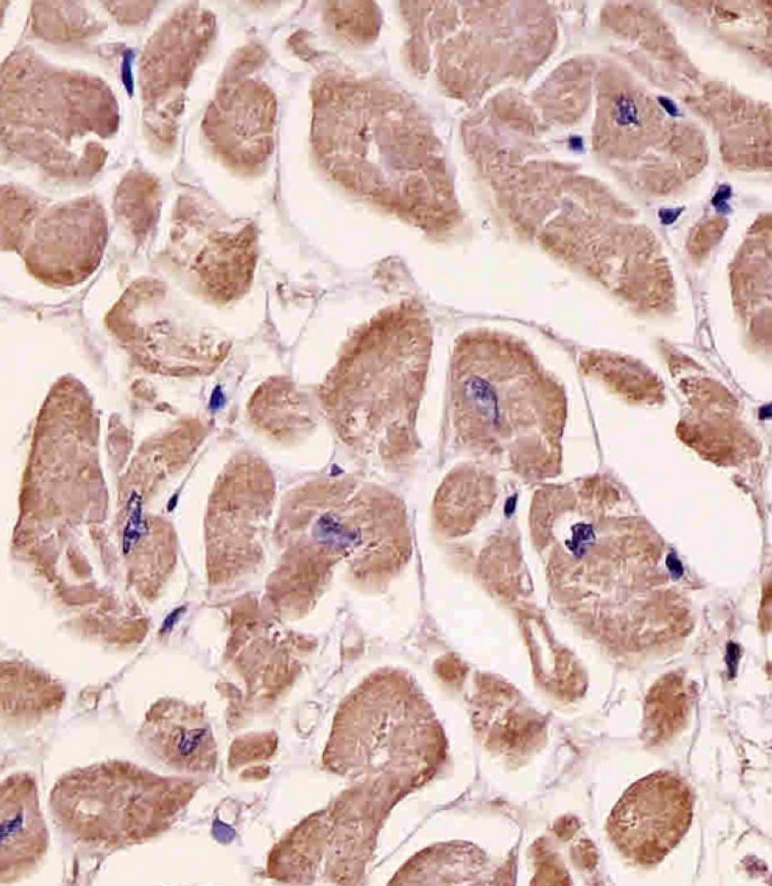 Antibody staining SPHK1 in human heart tissue sections by Immunohistochemistry (IHC-P - paraformaldehyde-fixed, paraffin-embedded sections).