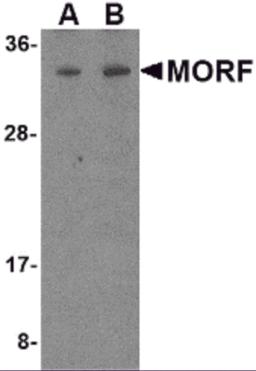 Western blot analysis of MORF4 in K562 cell lysate with MORF4 antibody at (A) 1 and (B) 2 &#956;g/mL.