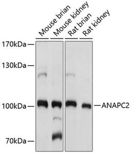 Western blot - ANAPC2 antibody (A8066)