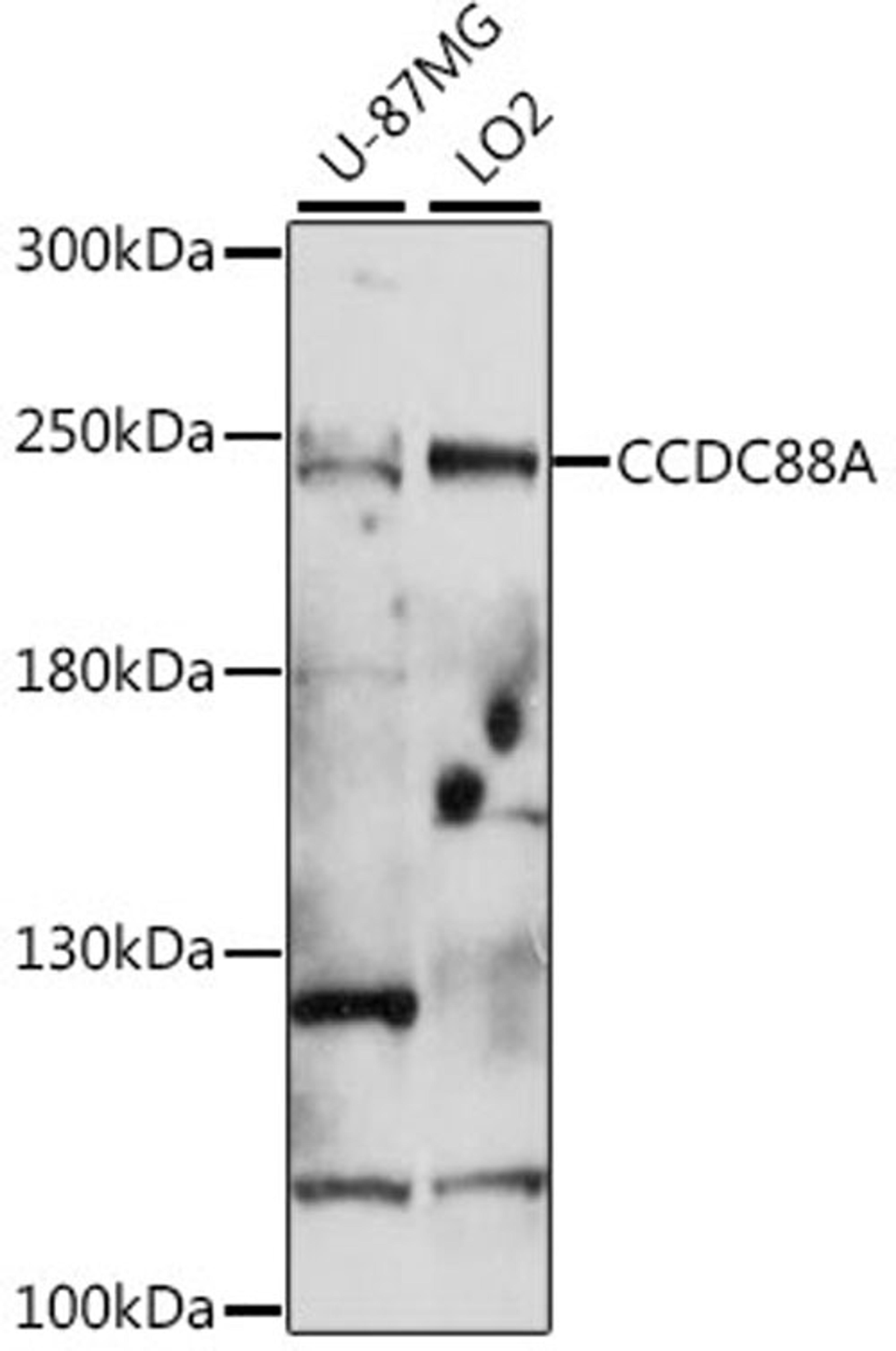 Western blot - CCDC88A antibody (A16132)