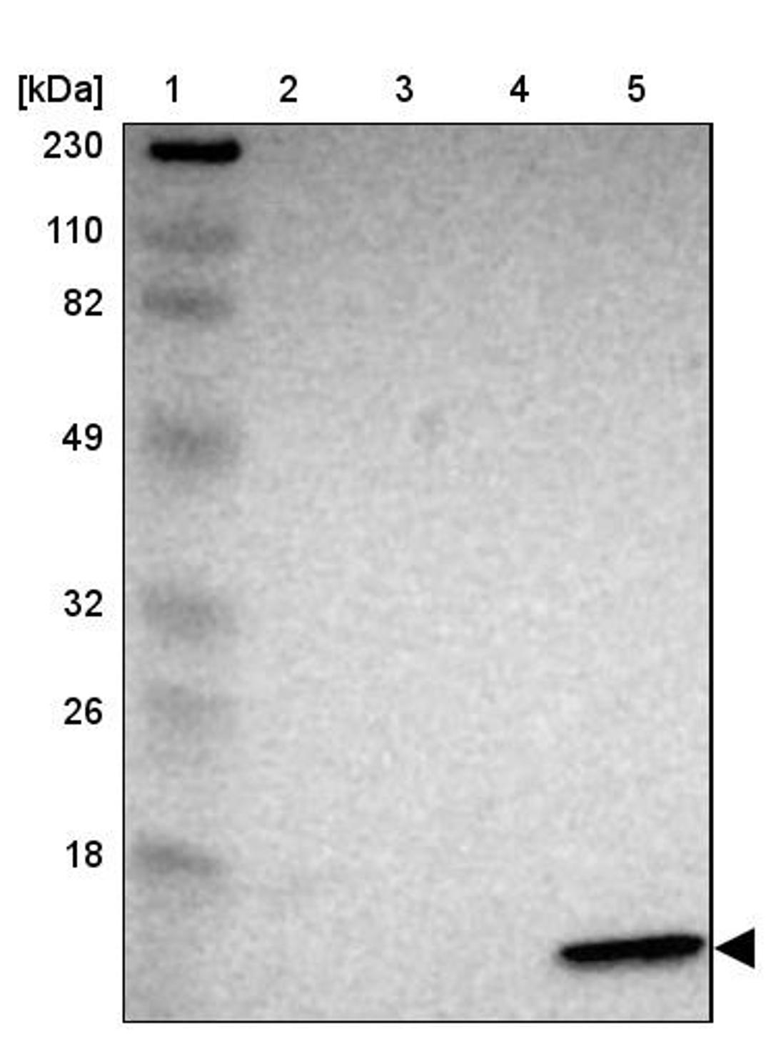 Western Blot: Galectin 2 Antibody [NBP1-89690] - Lane 1: Marker [kDa] 230, 110, 82, 49, 32, 26, 18<br/>Lane 2: Human cell line RT-4<br/>Lane 3: Human cell line U-251MG sp<br/>Lane 4: Human plasma (IgG/HSA depleted)<br/>Lane 5: Human liver tissue