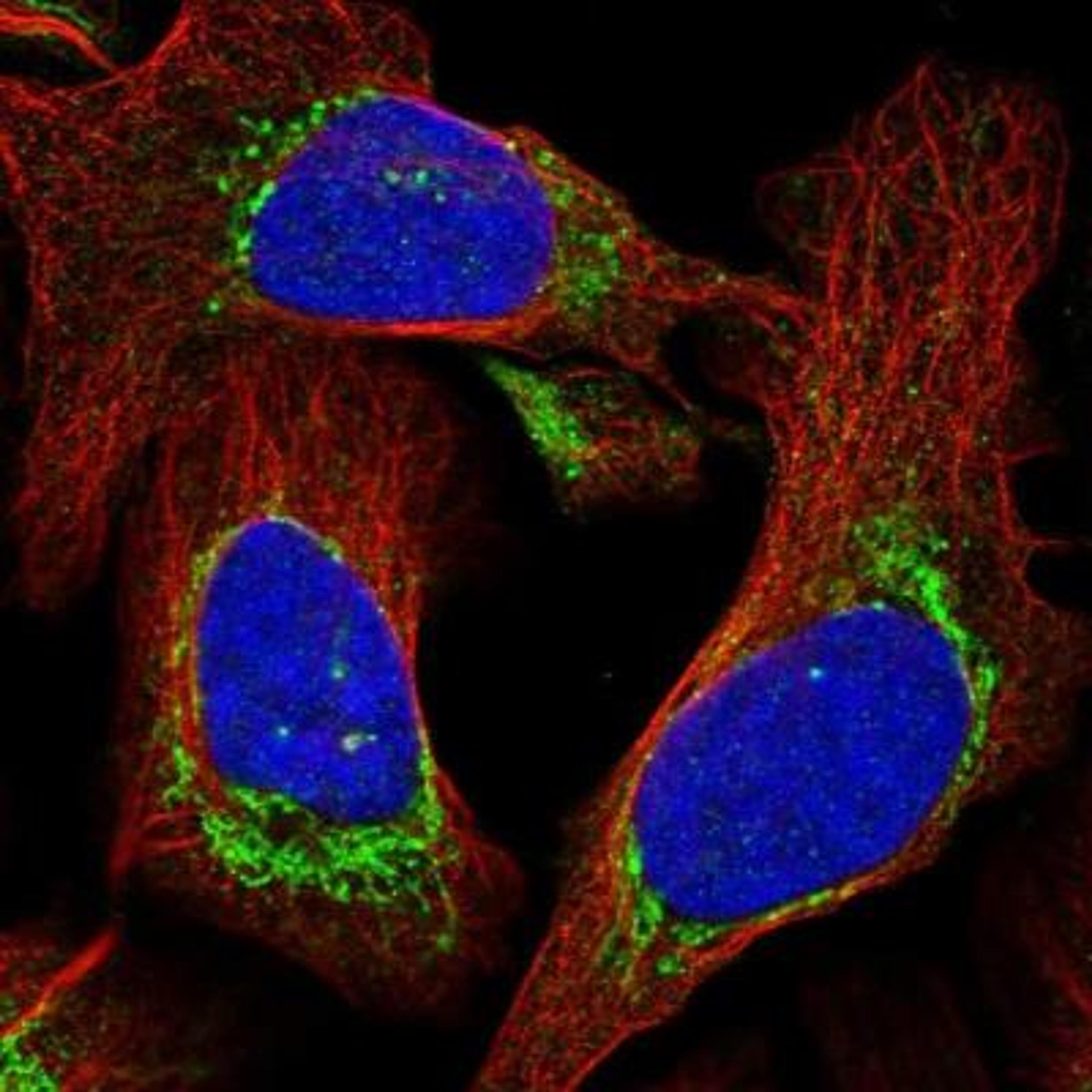 Immunocytochemistry/Immunofluorescence: MYBPC1 Antibody [NBP1-86427] - Staining of human cell line U-2 OS shows positivity in mitochondria.