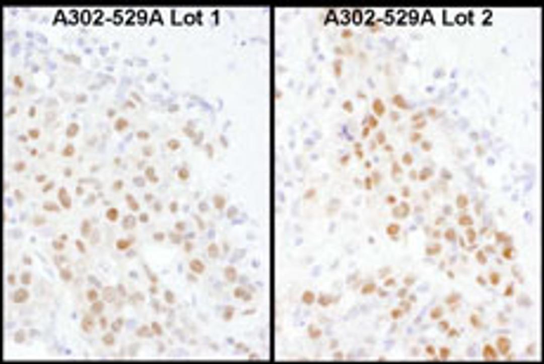 Detection of human MBD3 by immunohistochemistry.