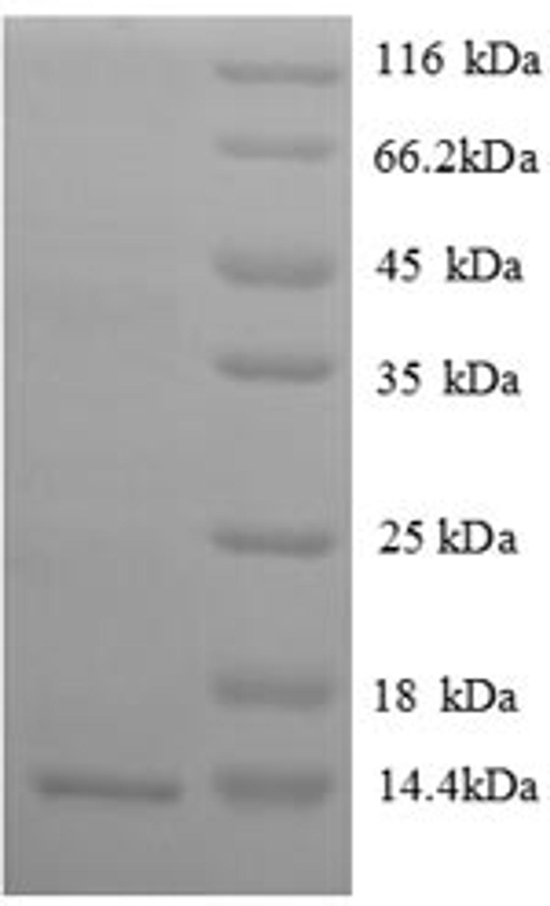 (Tris-Glycine gel) Discontinuous SDS-PAGE (reduced) with 5% enrichment gel and 15% separation gel.
