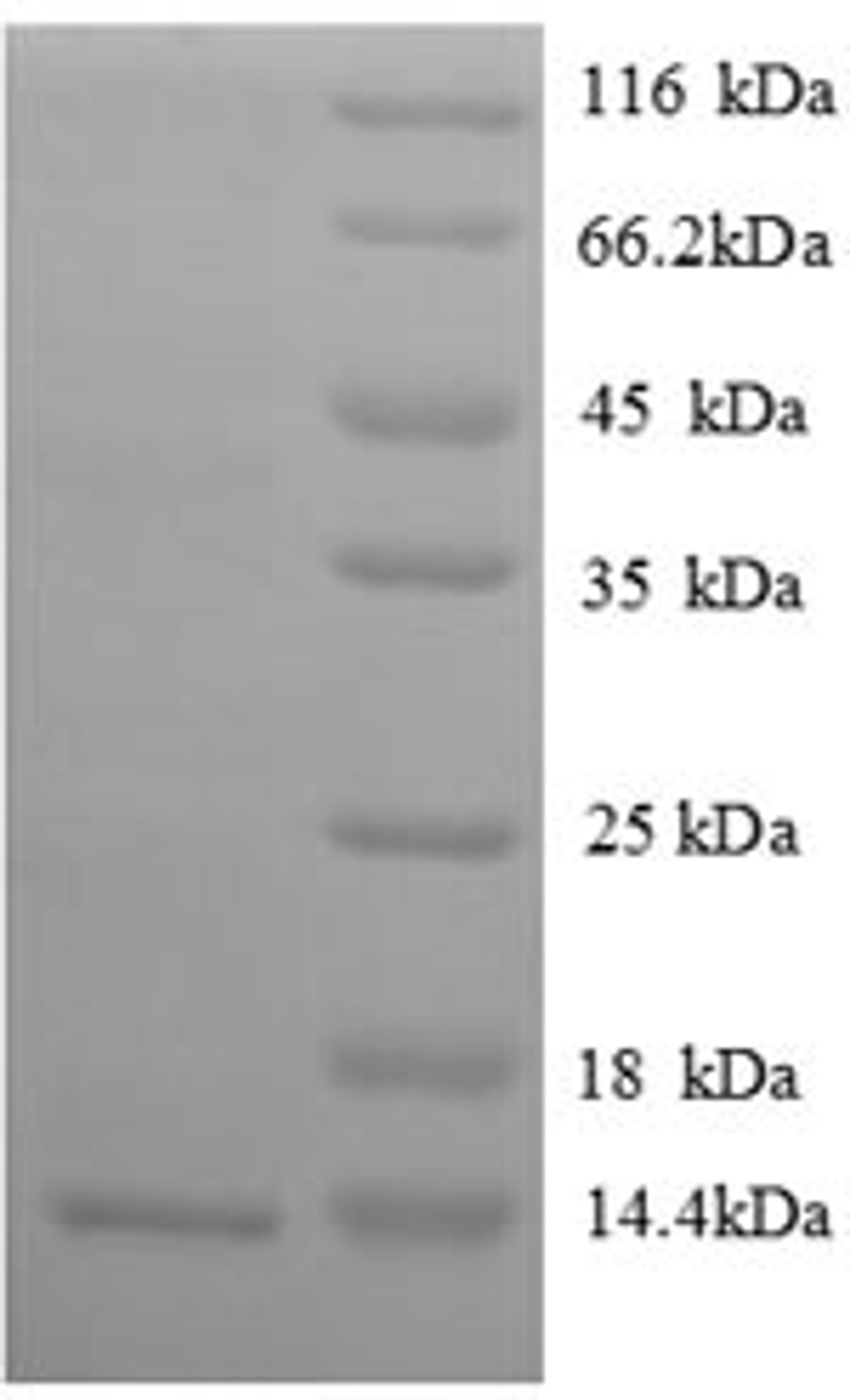 (Tris-Glycine gel) Discontinuous SDS-PAGE (reduced) with 5% enrichment gel and 15% separation gel.