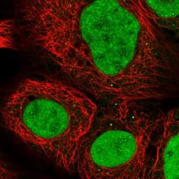 Immunocytochemistry/Immunofluorescence: PRDM10 Antibody [NBP1-81427] - Staining of human cell line A-431 shows positivity in nucleoli, nucleus but not nucleoli & vesicles.