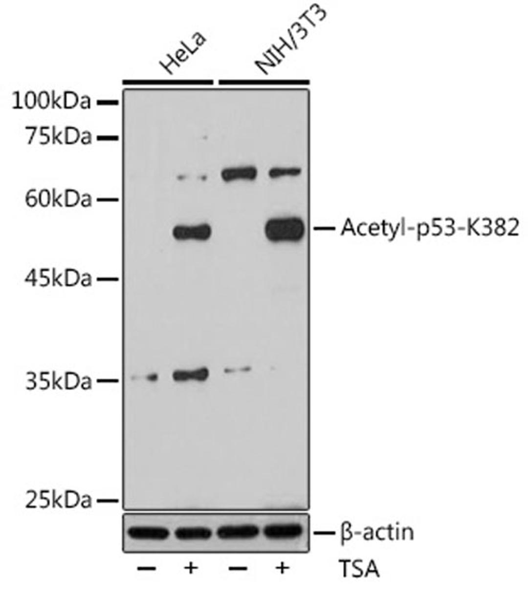 Western blot - Acetyl-p53-K382 antibody (A16324)