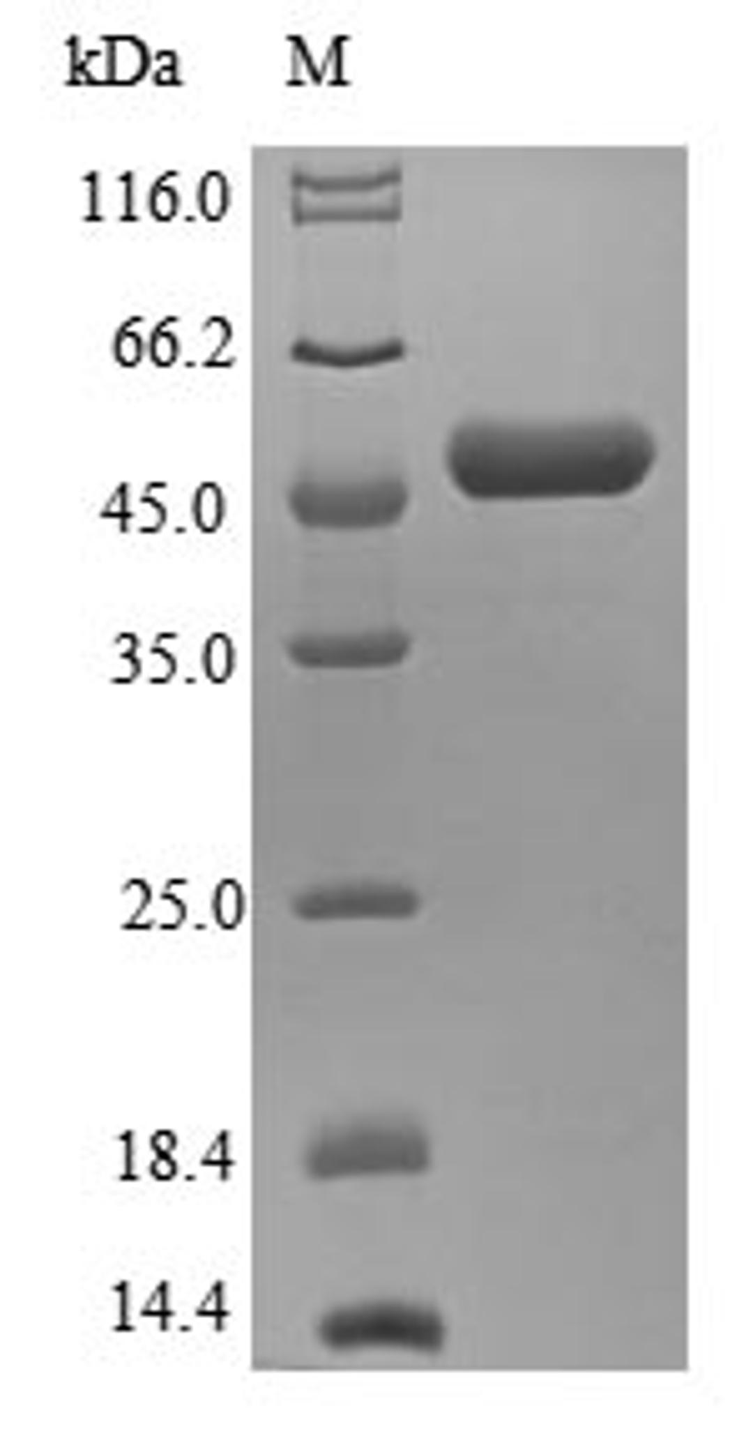 (Tris-Glycine gel) Discontinuous SDS-PAGE (reduced) with 5% enrichment gel and 15% separation gel.