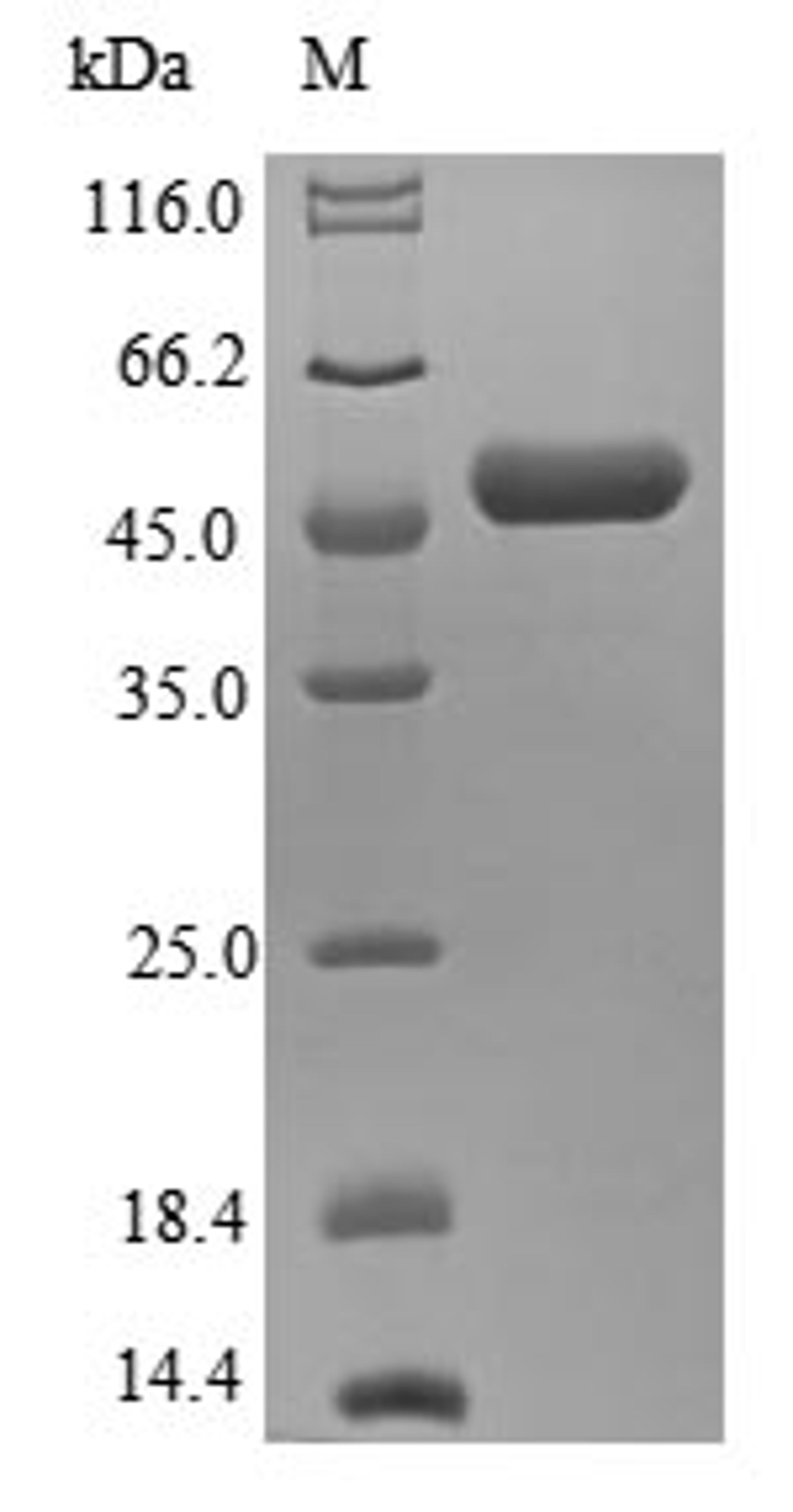 (Tris-Glycine gel) Discontinuous SDS-PAGE (reduced) with 5% enrichment gel and 15% separation gel.
