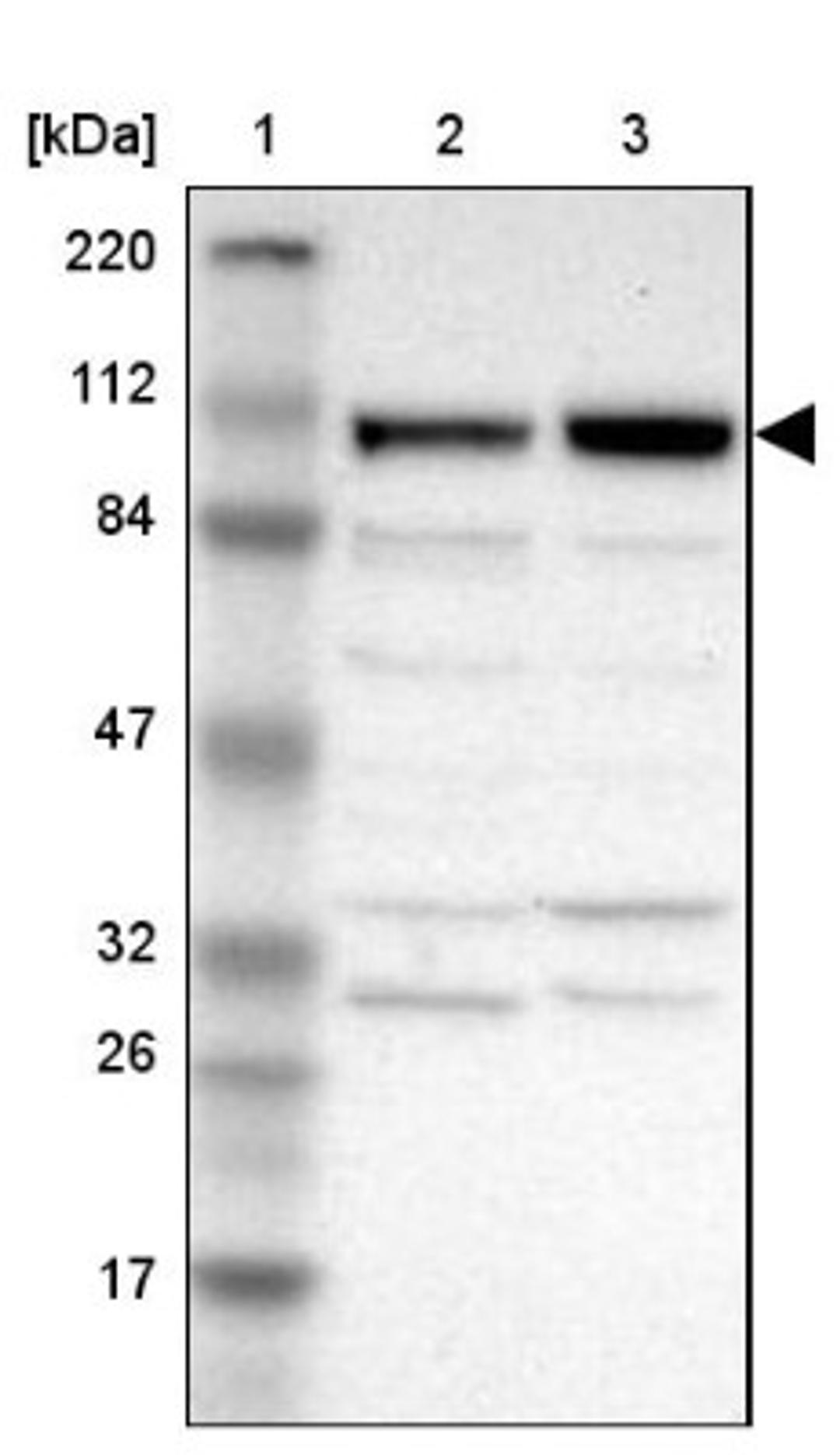 Western Blot: ANKLE2 Antibody [NBP1-82970] - Lane 1: Marker [kDa] 220, 112, 84, 47, 32, 26, 17<br/>Lane 2: Human cell line RT-4<br/>Lane 3: Human cell line U-251MG sp