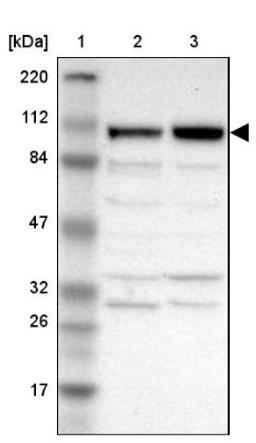 Western Blot: ANKLE2 Antibody [NBP1-82970] - Lane 1: Marker [kDa] 220, 112, 84, 47, 32, 26, 17<br/>Lane 2: Human cell line RT-4<br/>Lane 3: Human cell line U-251MG sp