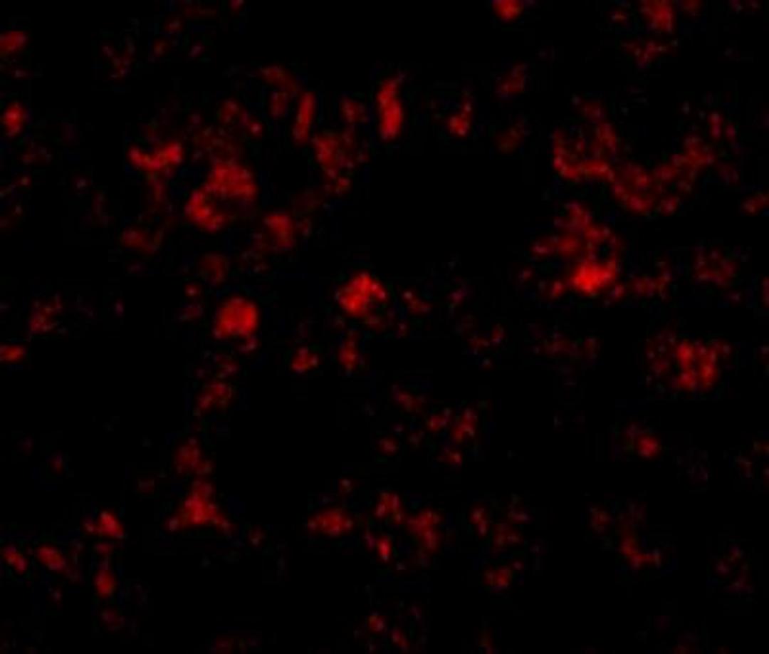 Immunocytochemistry/Immunofluorescence: THEM4 Antibody [NBP1-77360] - Immunofluorescence of THEM4 in human liver tissue with THEM4 antibody at 20 ug/mL.