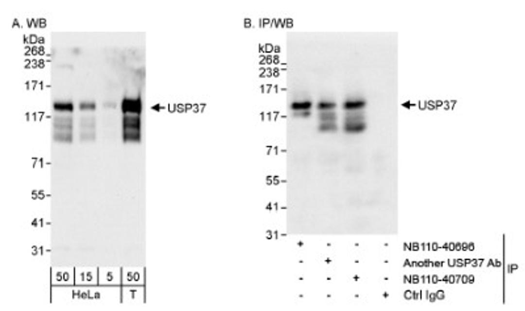 Western Blot: USP37 Antibody [NB110-40709] - Detection of Human USP37 on HeLa whole cell lysate using NB110-40709. USP37 was also immunoprecipitated by rabbit anti-USP37 antibody NB110-40696.