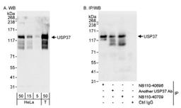 Western Blot: USP37 Antibody [NB110-40709] - Detection of Human USP37 on HeLa whole cell lysate using NB110-40709. USP37 was also immunoprecipitated by rabbit anti-USP37 antibody NB110-40696.