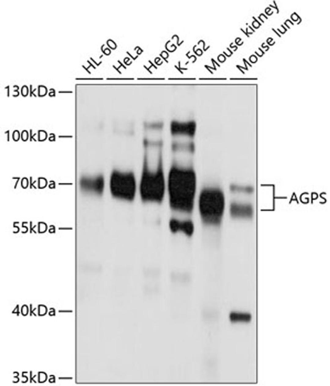 Western blot - AGPS antibody (A10484)