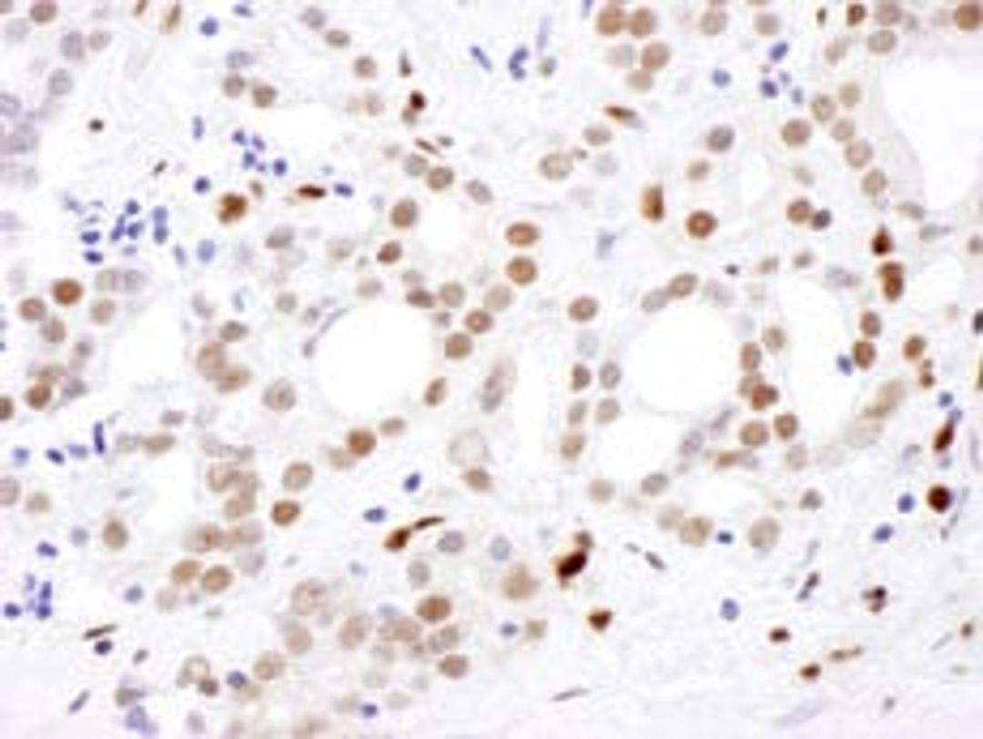 Detection of human SAMHD1 by immunohistochemistry.