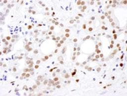 Detection of human SAMHD1 by immunohistochemistry.