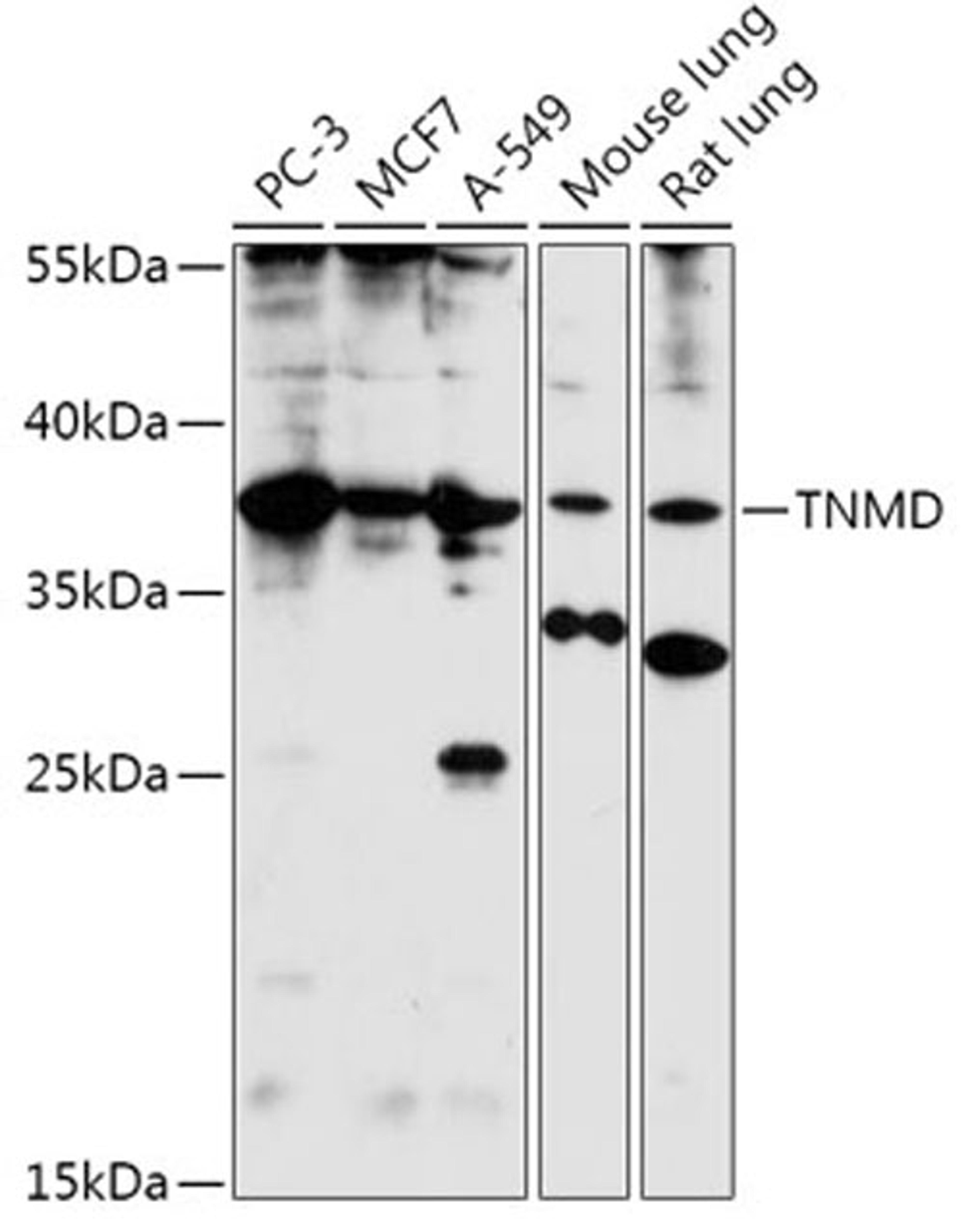 Western blot - TNMD antibody (A17753)