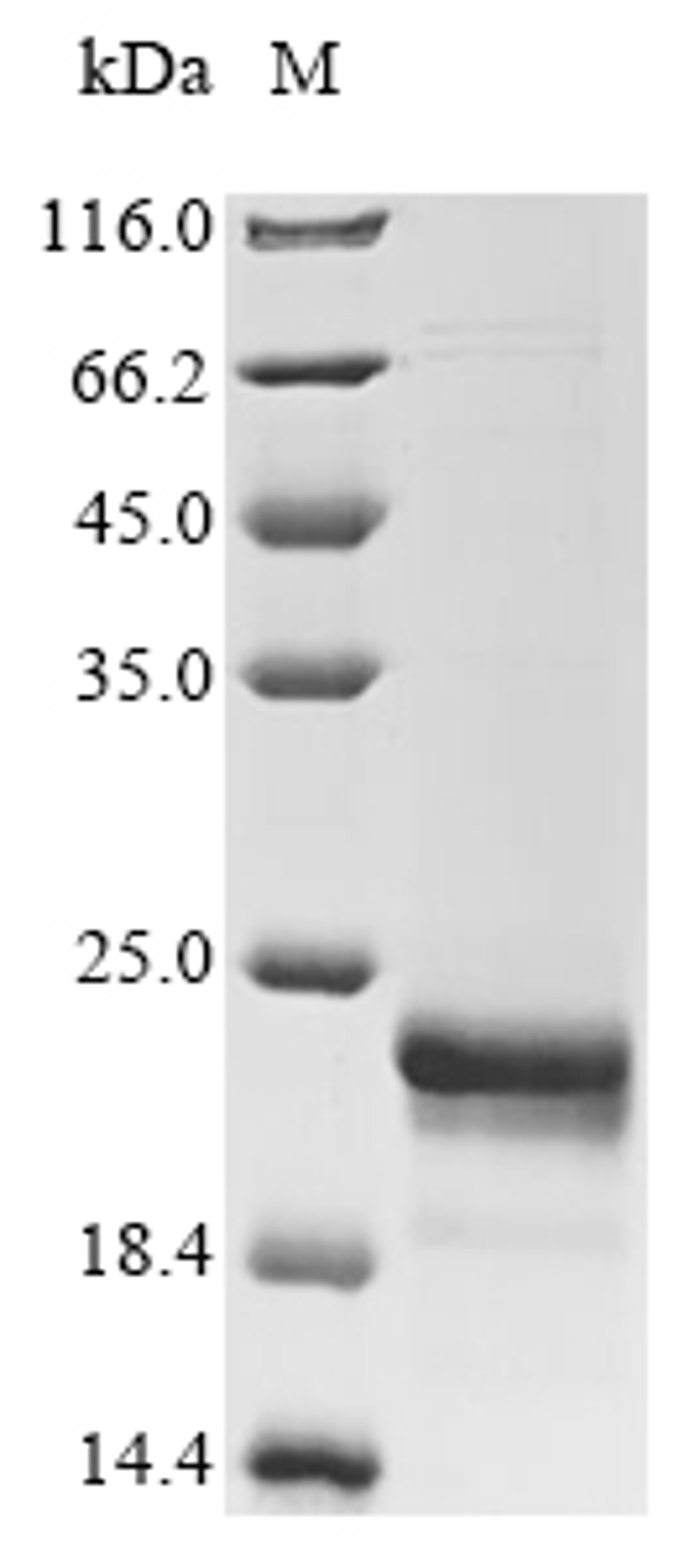 (Tris-Glycine gel) Discontinuous SDS-PAGE (reduced) with 5% enrichment gel and 15% separation gel.