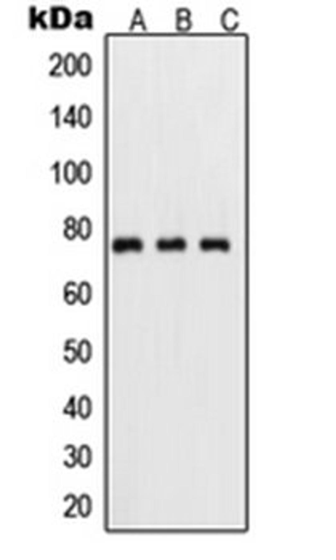 Western blot analysis of HeLa TNFa-treated (Lane 1), mouse kidney (Lane 2), PC12 UV-treated (Lane 3) whole cell lysates using RELA antibody