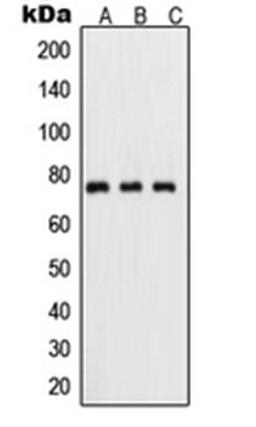 Western blot analysis of HeLa TNFa-treated (Lane 1), mouse kidney (Lane 2), PC12 UV-treated (Lane 3) whole cell lysates using RELA antibody