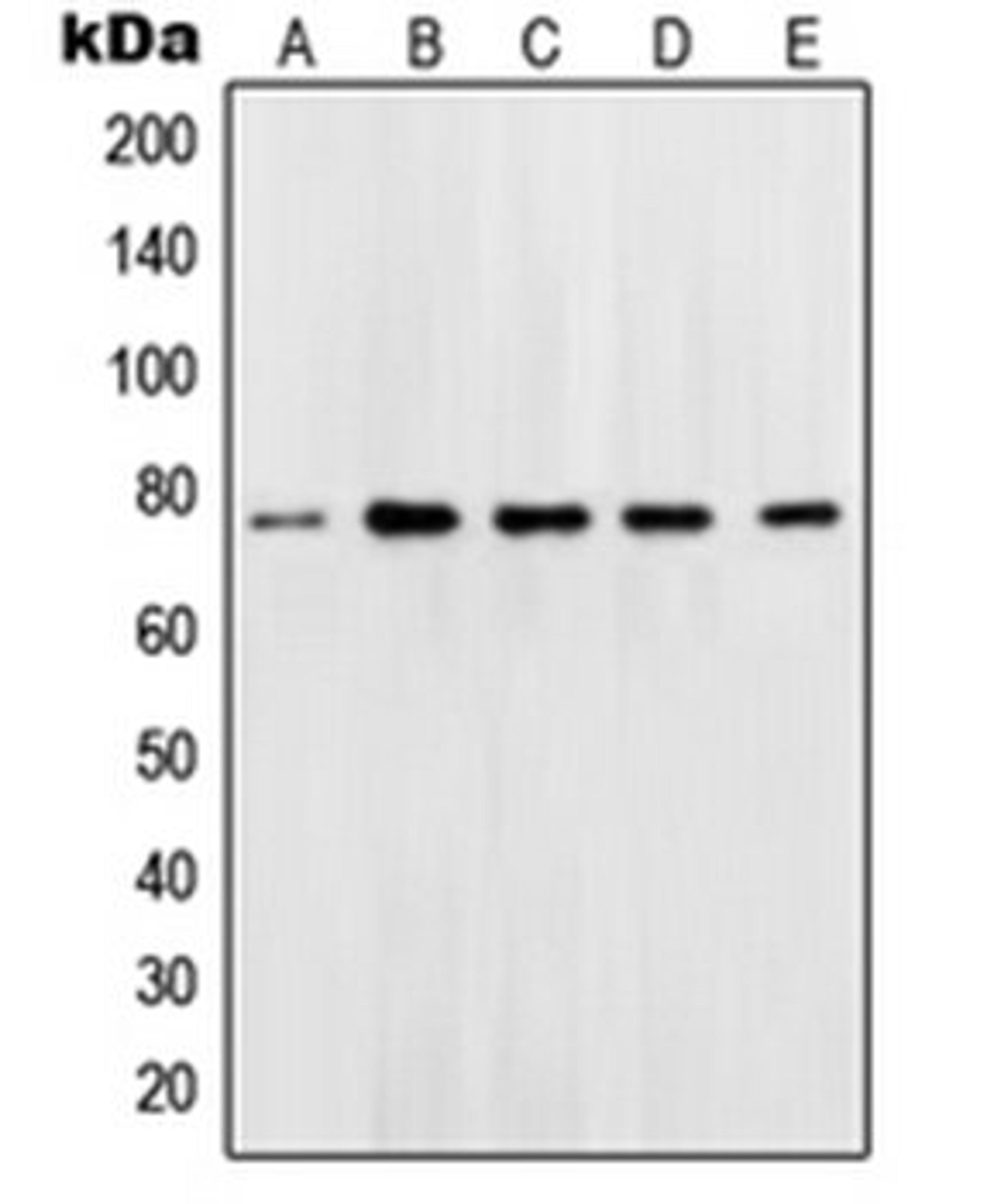 Western blot analysis of Jurkat (Lane 1), Ramos (Lane 2), K562 (Lane 3), Molt (Lane 4), HeLa (Lane 5) whole cell lysates using POU2F1 antibody