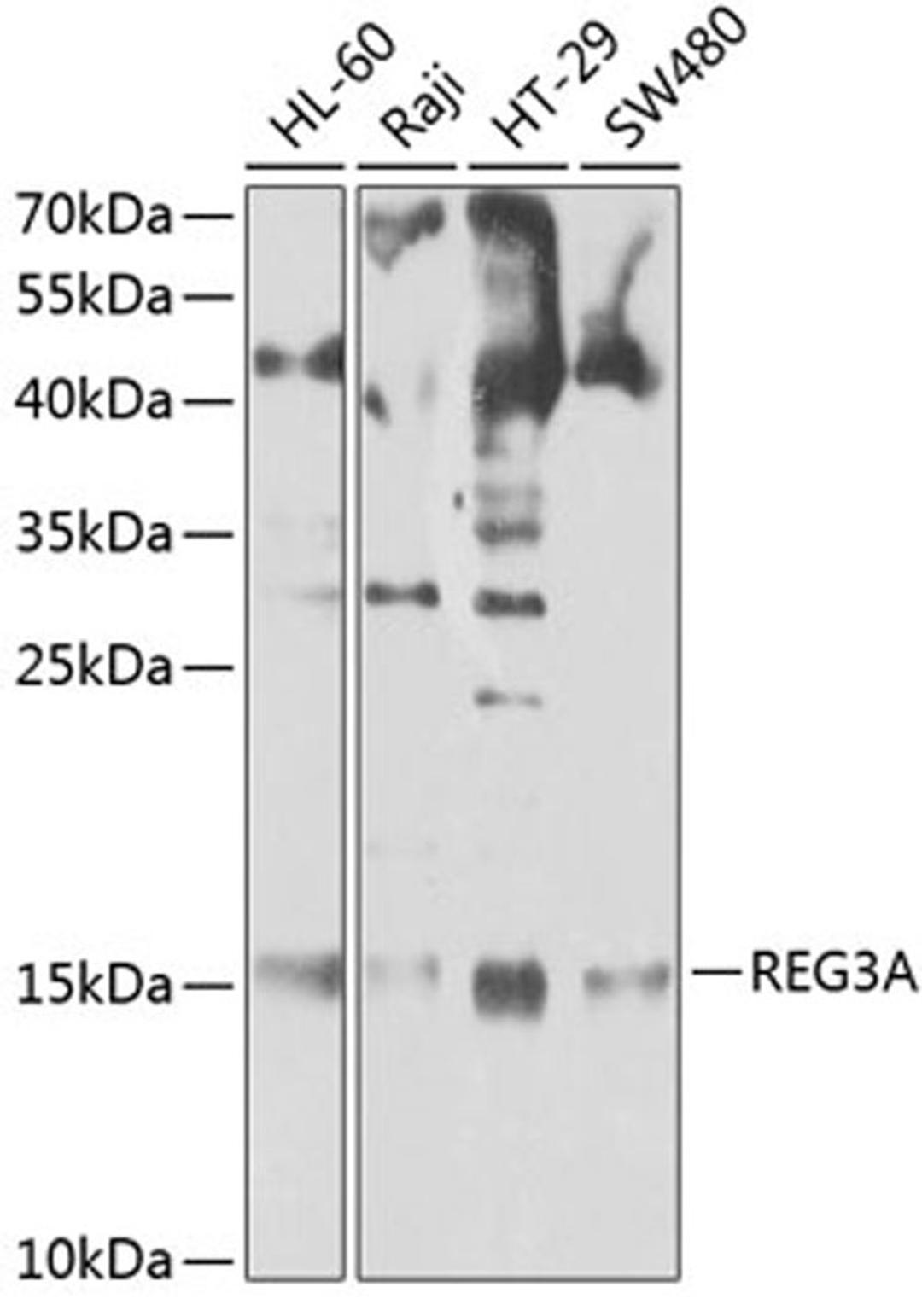 Western blot - REG3A antibody (A2101)