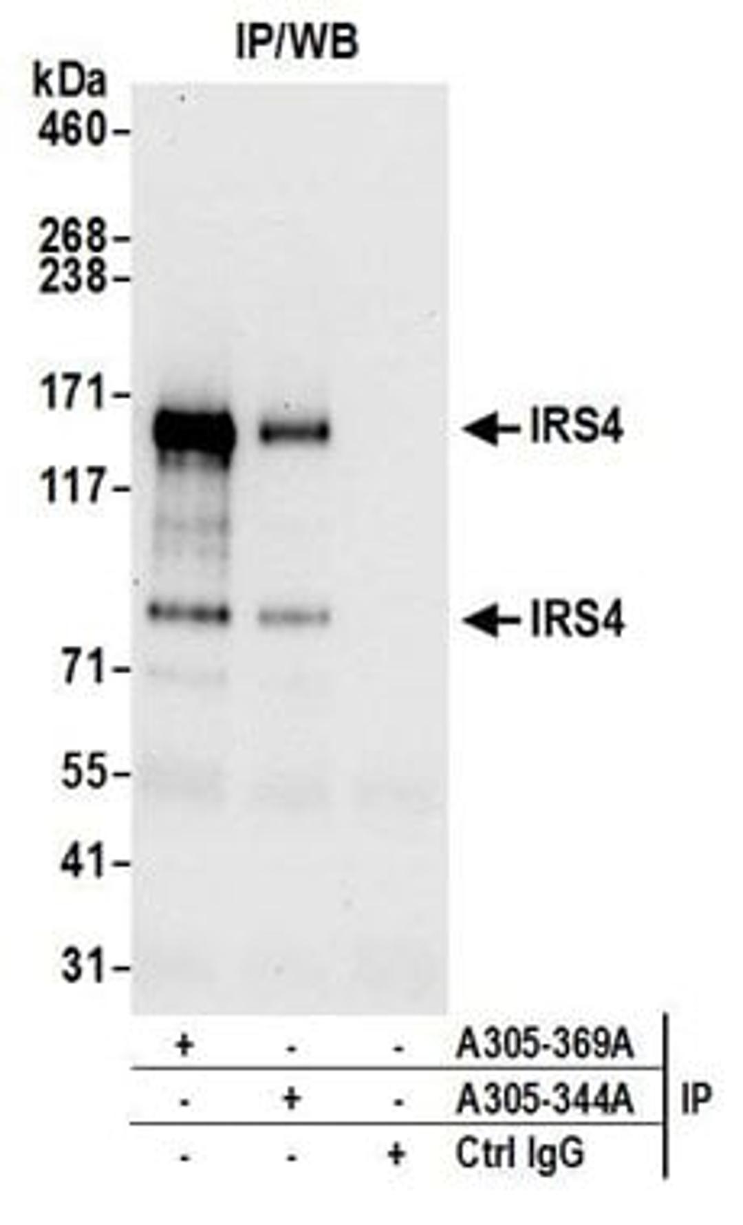 Detection of human IRS4 by western blot of immunoprecipitates.