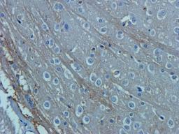 Immunohistochemical staining of paraffin embedded rat brain tissue using OAT3 antibody (2.5 ug/ml)