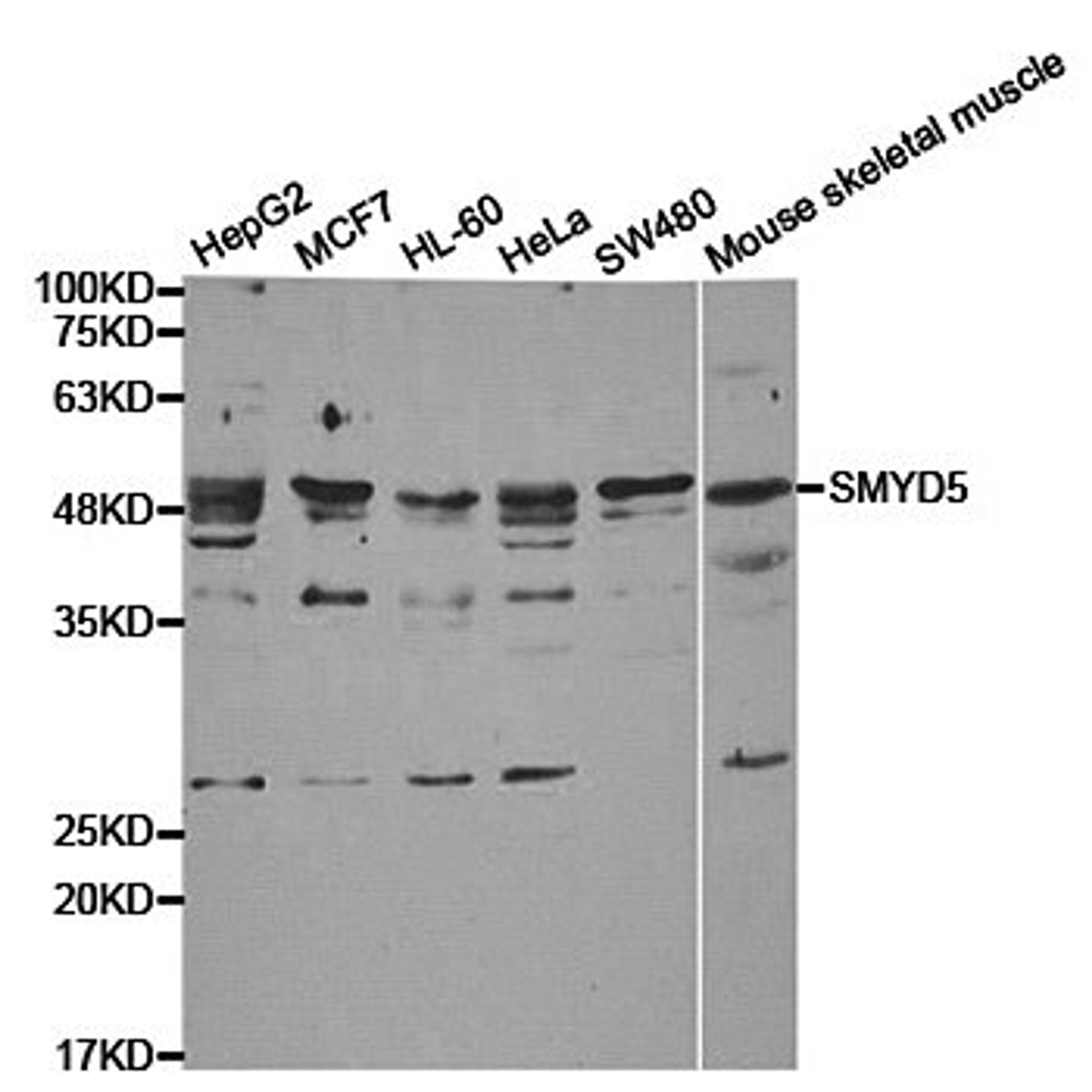 Western blot analysis of extracts of various cell lines using SMYD5 antibody.