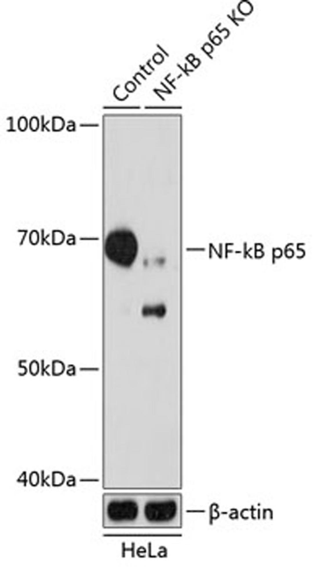 Western blot - NF-kB p65 antibody (A19653)