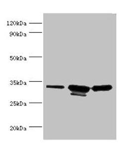 Western blot. All lanes: CAPZB antibody at 6µg/ml. Lane 1: 293T whole cell lysate. Lane 2: A431 whole cell lysate. Lane 3: Jurkat whole cell lysate. Secondary. Goat polyclonal to rabbit IgG at 1/10000 dilution. Predicted band size: 32, 31 kDa. Observed band size: 32, 31 kDa