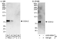 Detection of human COX-2 by western blot and immunoprecipitation.