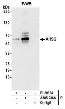 Detection of human AHSG by western blot of immunoprecipitates.