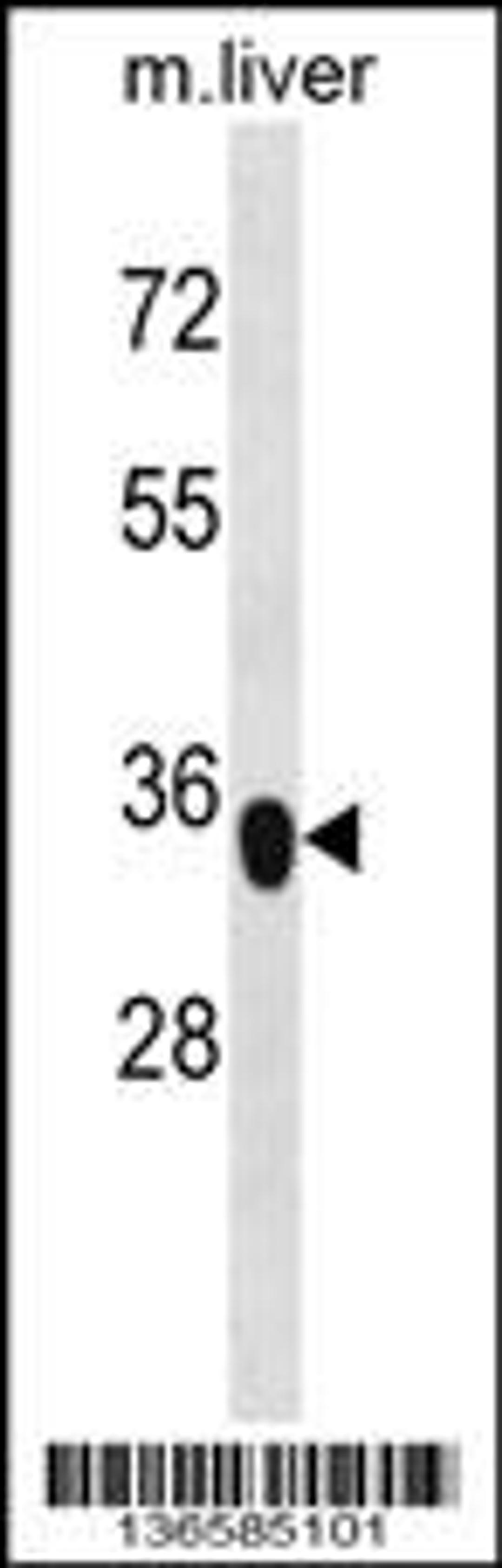 Western blot analysis in mouse liver tissue lysates (35ug/lane).