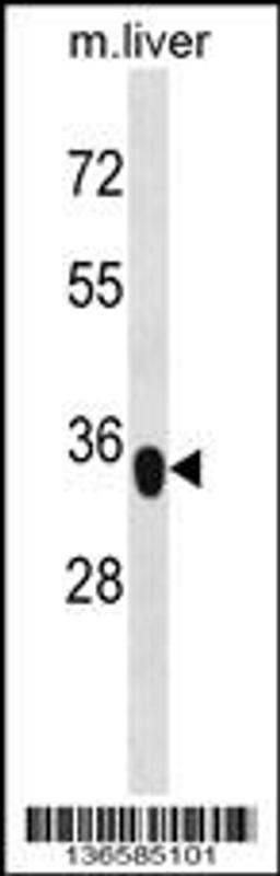 Western blot analysis in mouse liver tissue lysates (35ug/lane).