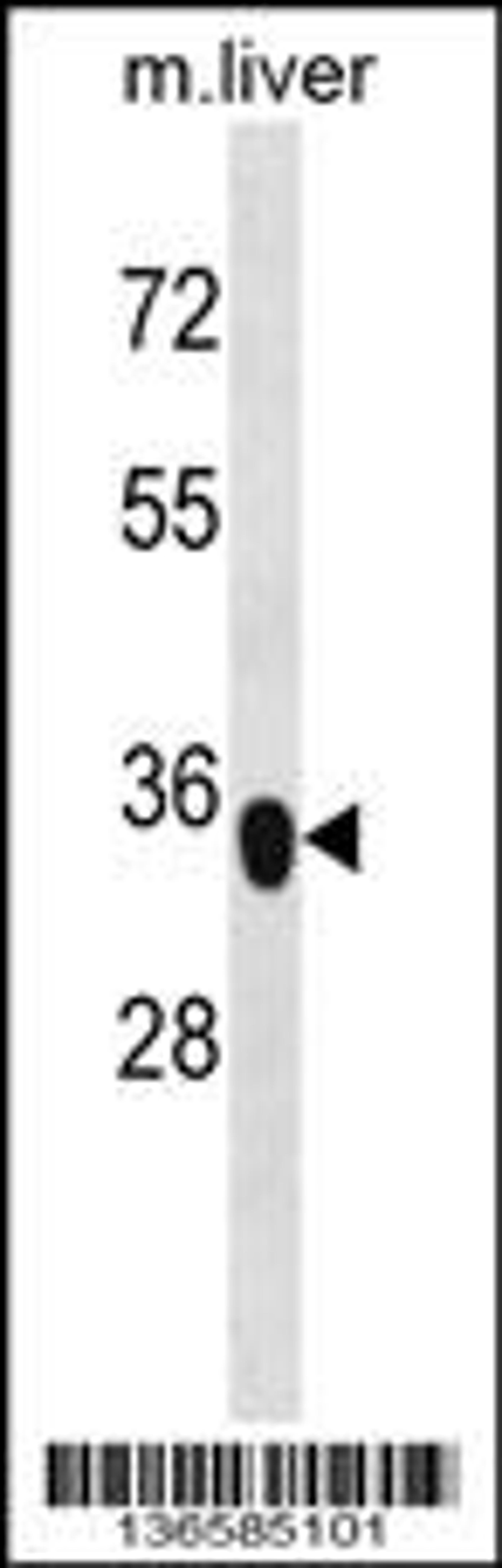 Western blot analysis in mouse liver tissue lysates (35ug/lane).