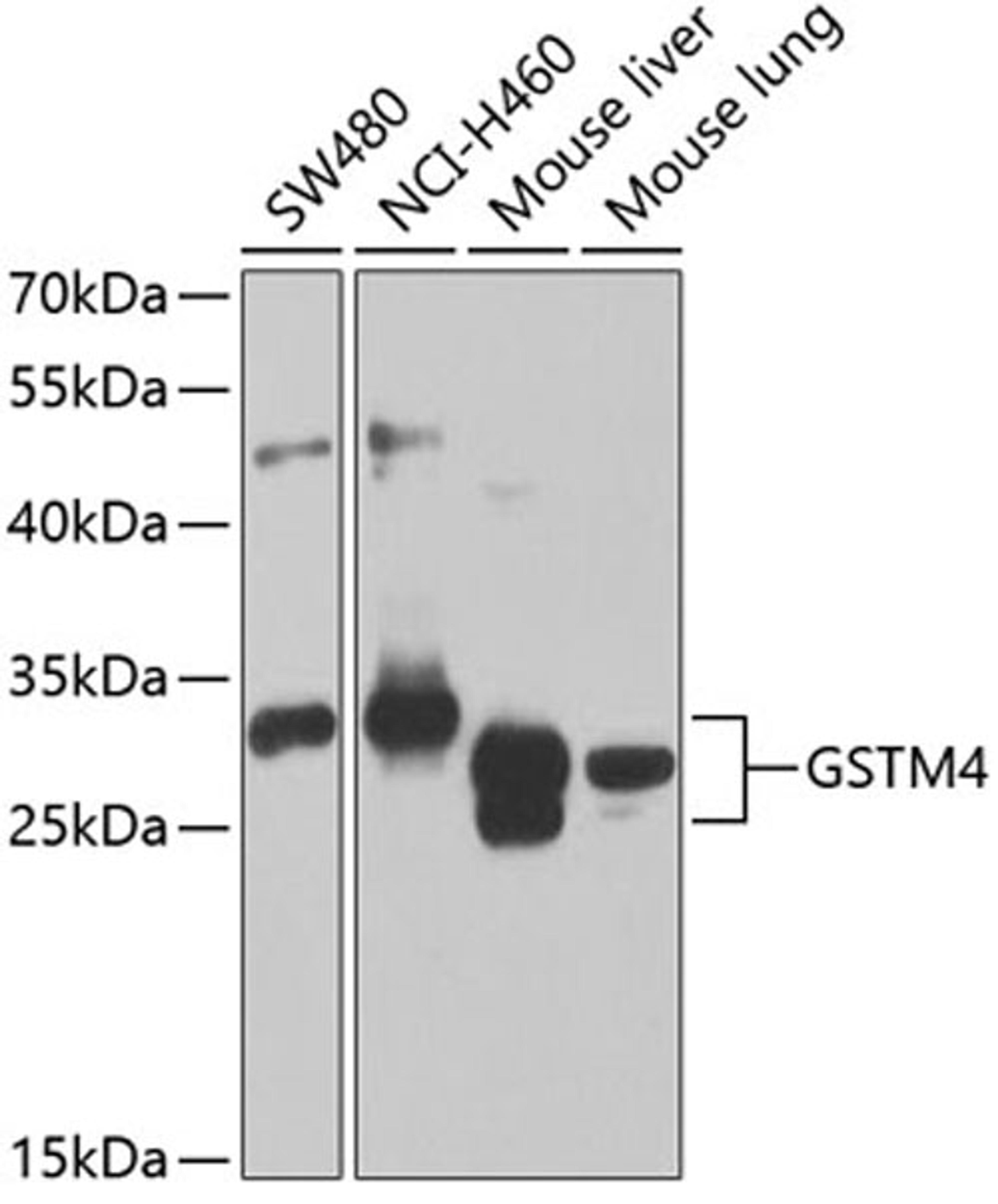 Western blot - GSTM4 antibody (A7434)