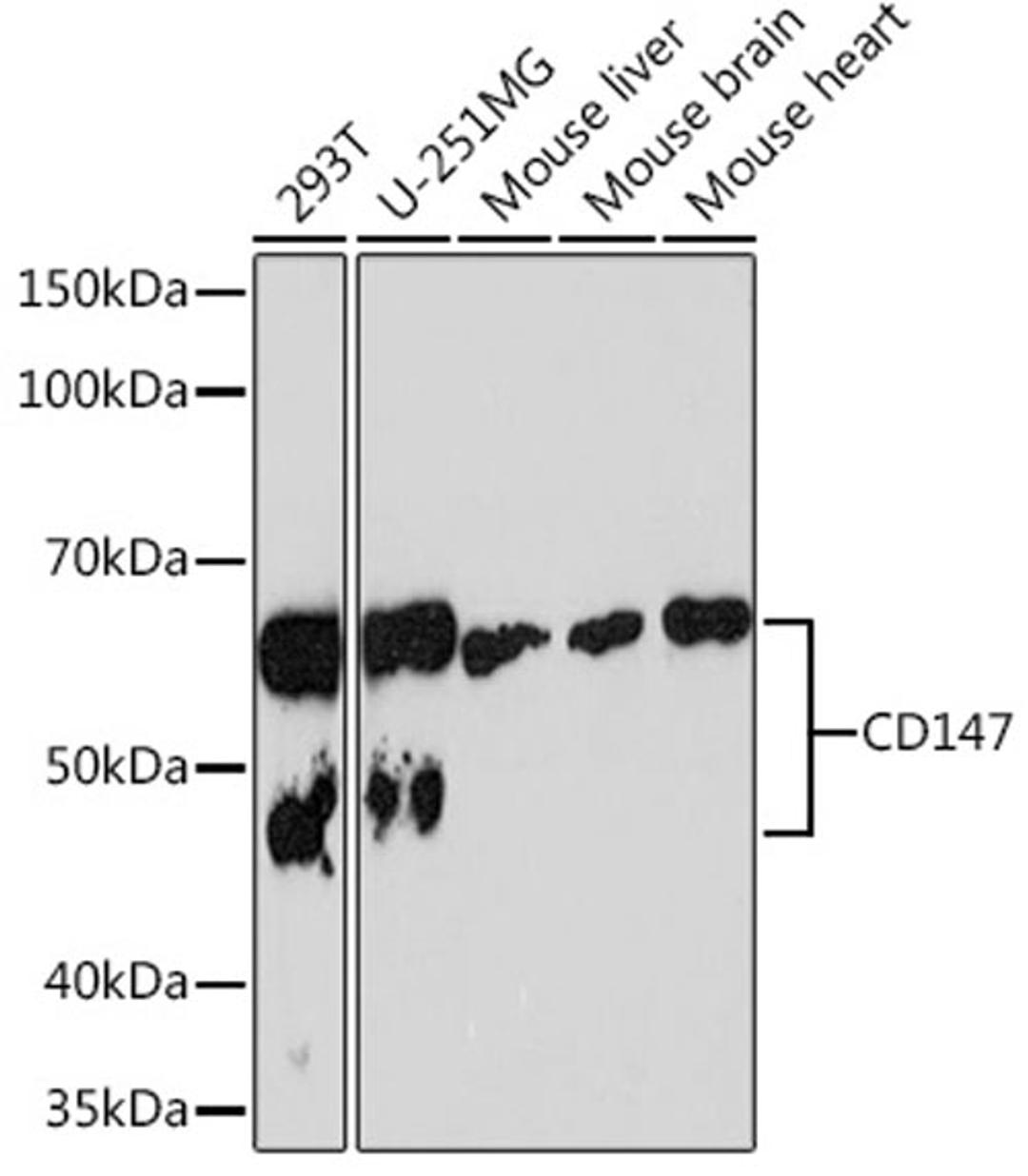 Western blot - CD147 Rabbit mAb (A4310)