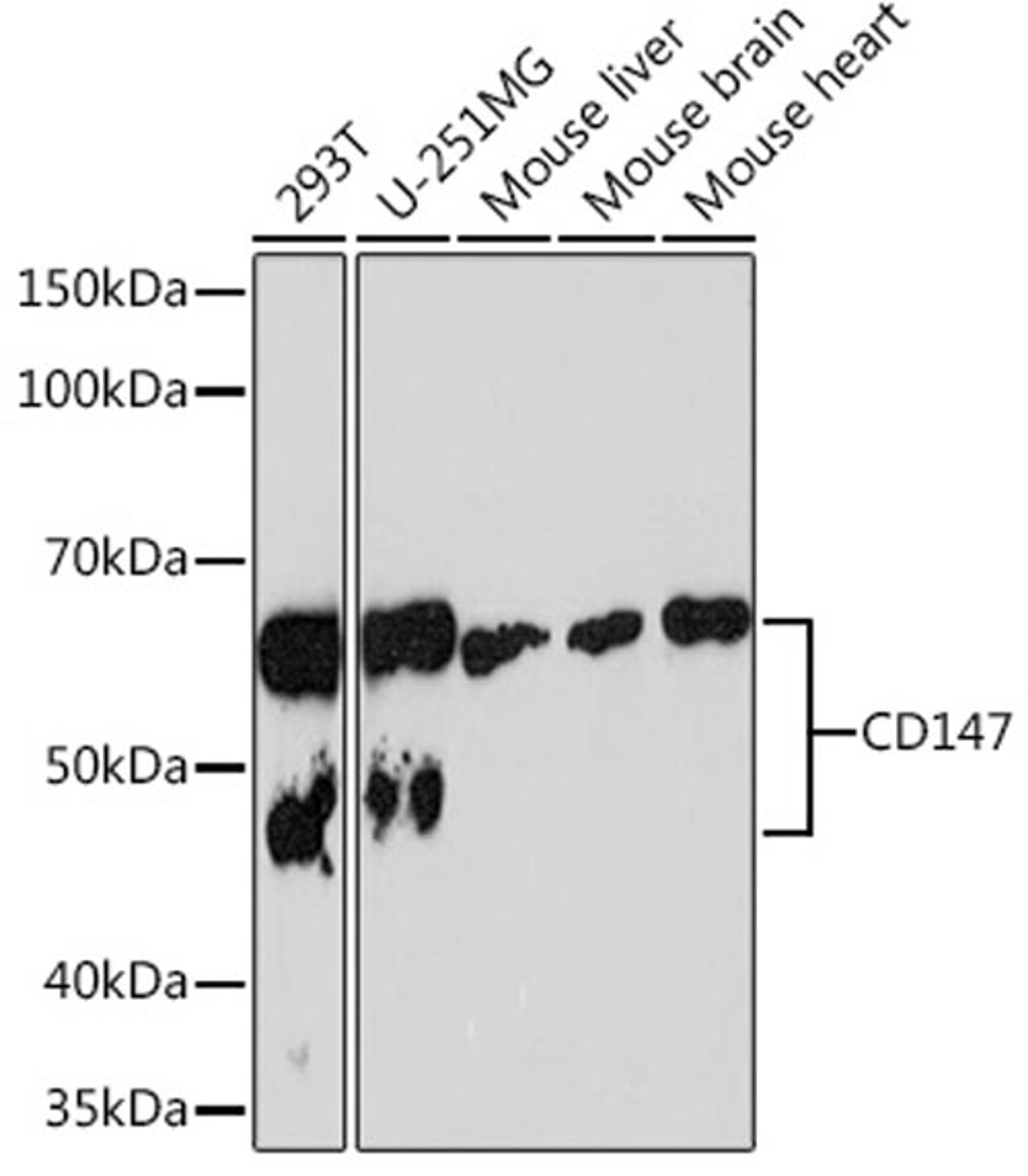 Western blot - CD147 Rabbit mAb (A4310)