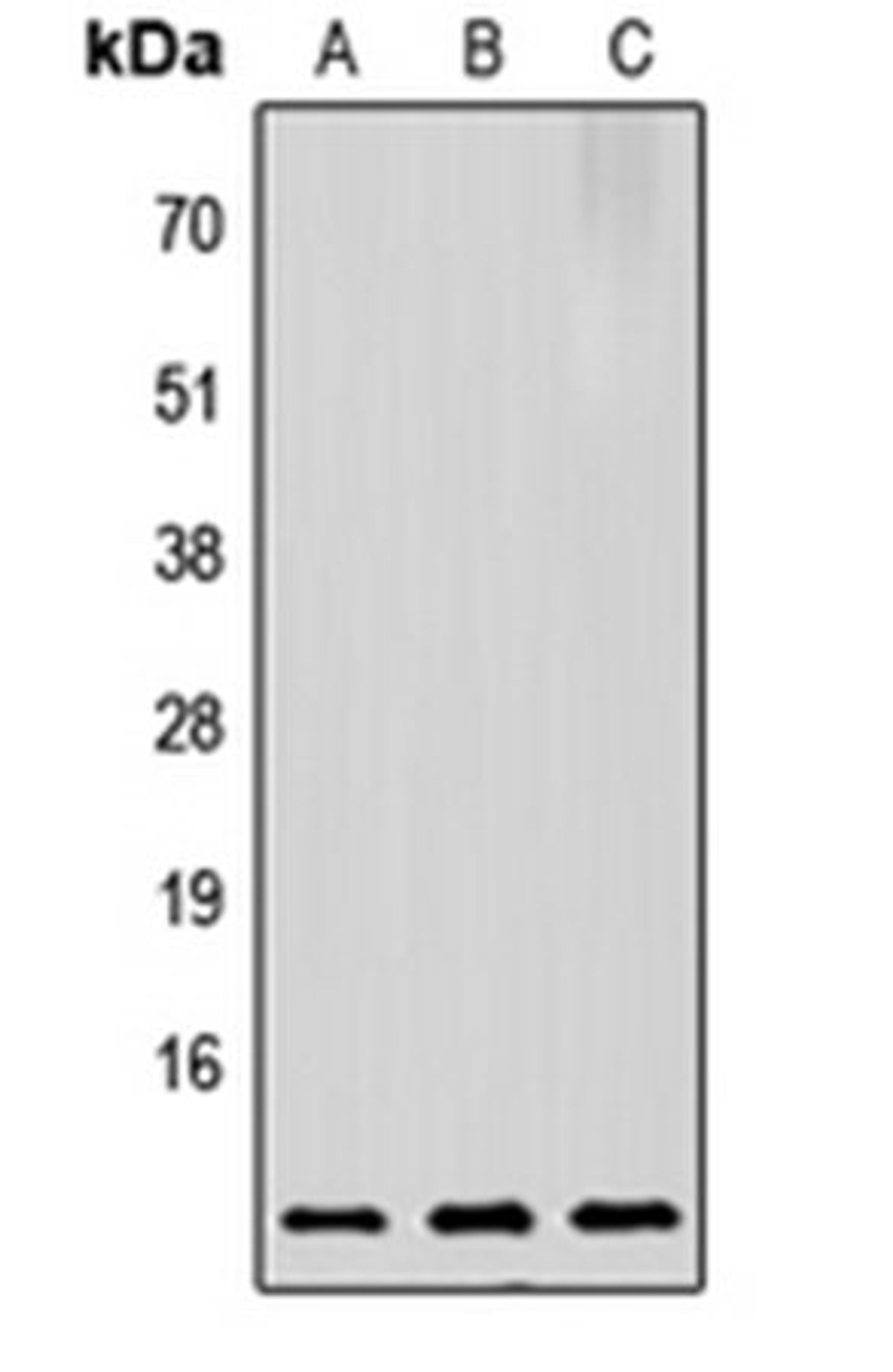 Western blot analysis of HeLa (Lane 1), Raw264.7 (Lane 2), PC12 (Lane 3) whole cell lysates using Prothymosin alpha antibody