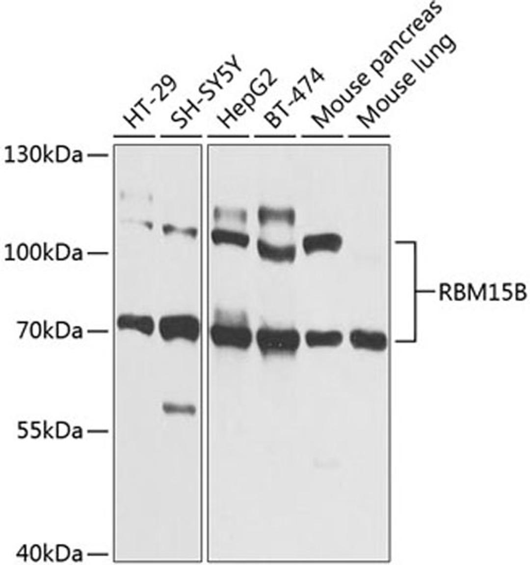 Western blot - RBM15B Antibody (A9873)