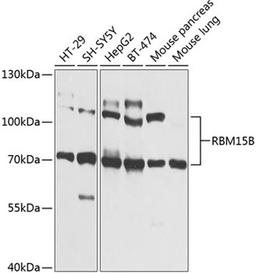 Western blot - RBM15B Antibody (A9873)