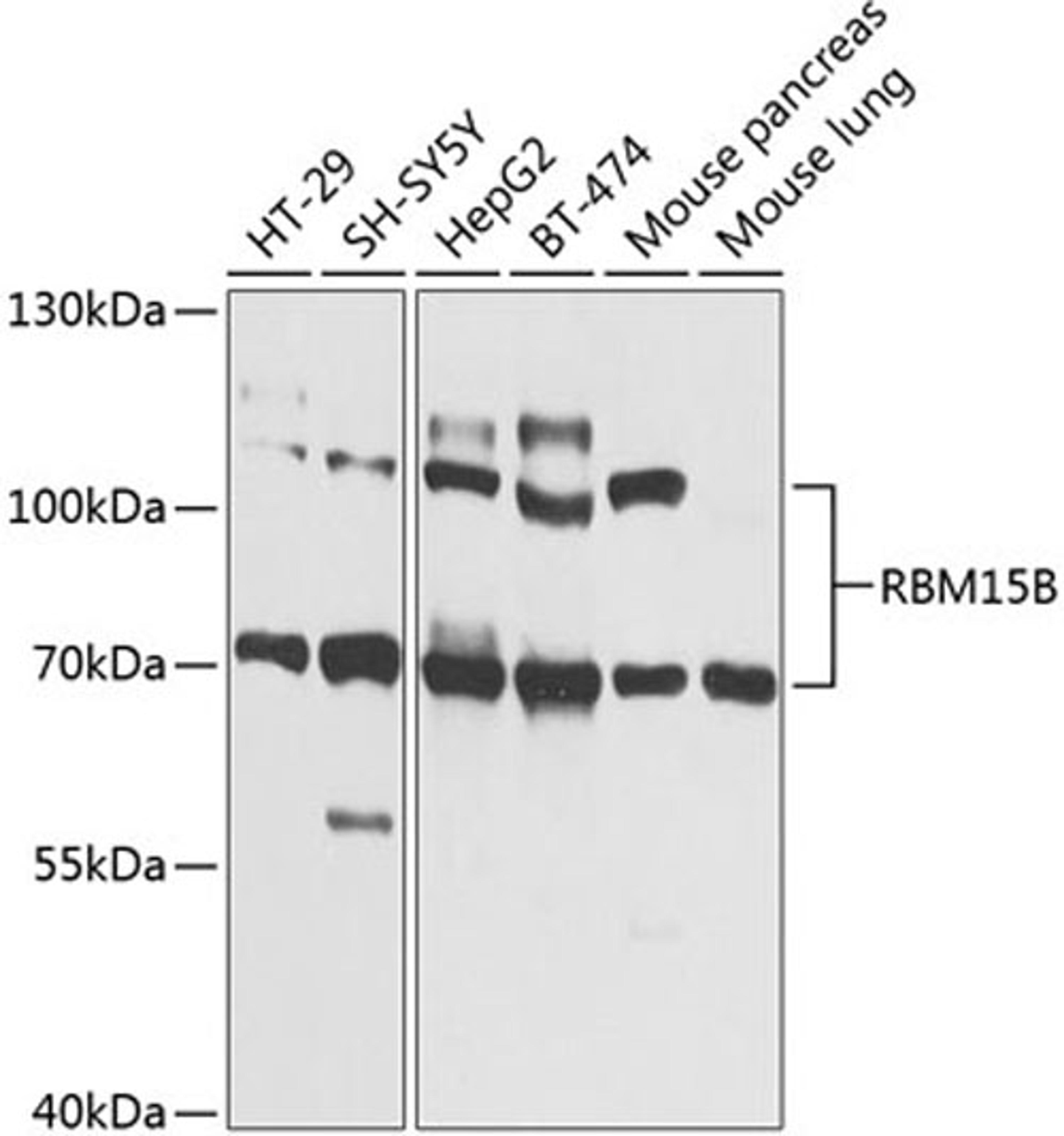 Western blot - RBM15B Antibody (A9873)