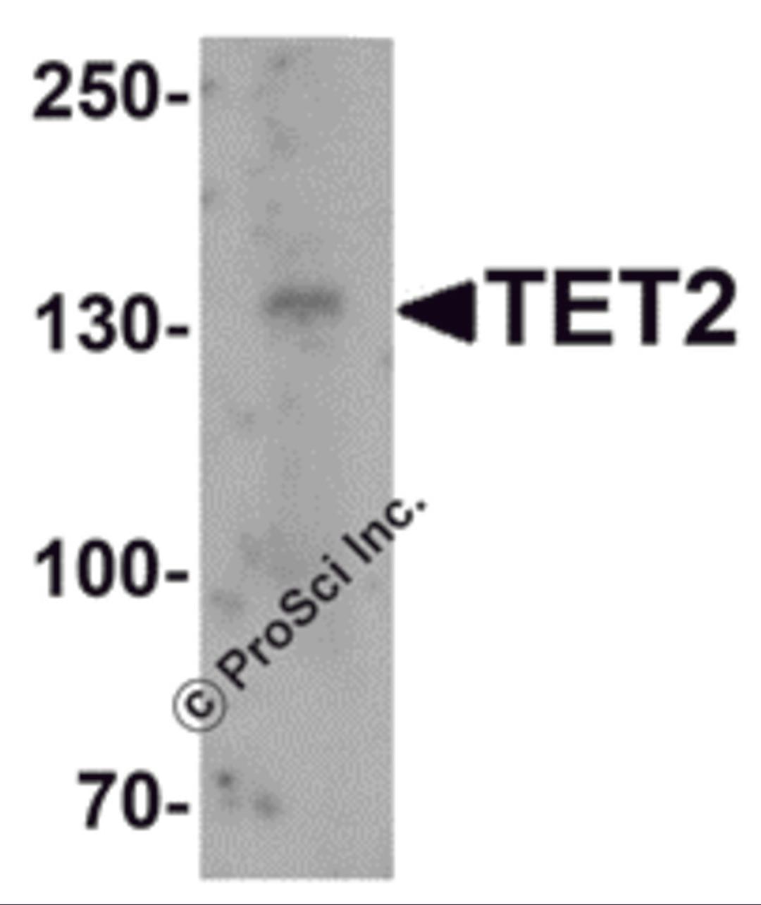 Western blot analysis of TET2 in SK-N-SH cell lysate with TET2 antibody at 1 μg/mL.