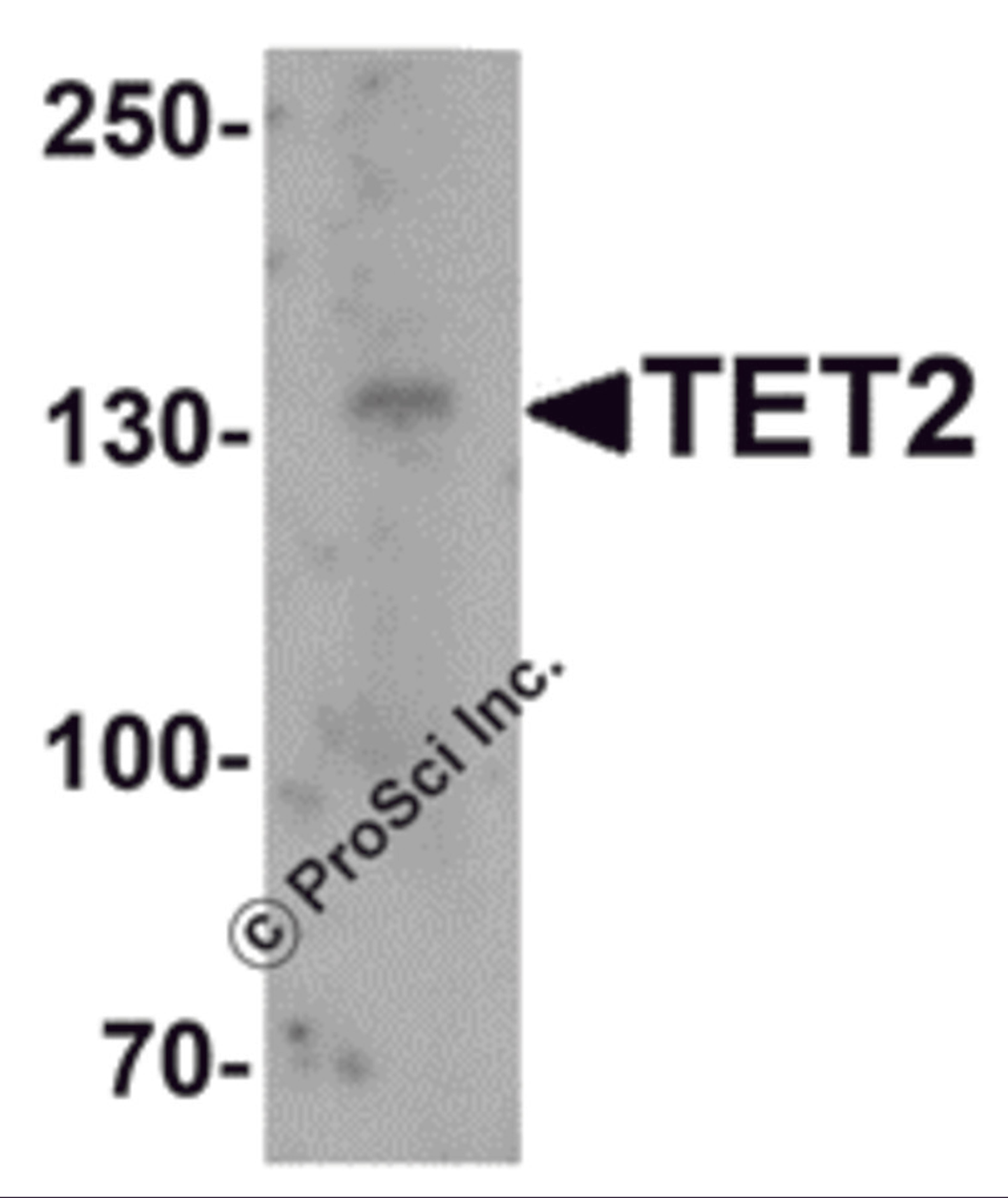 Western blot analysis of TET2 in SK-N-SH cell lysate with TET2 antibody at 1 μg/mL.